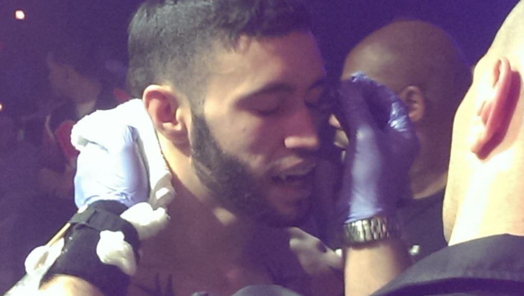 MMA fighter getting medial help for his eye